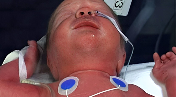 Paediatric respiratory examination